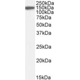 Western Blot - Anti-Factor H Antibody (A82643) - Antibodies.com