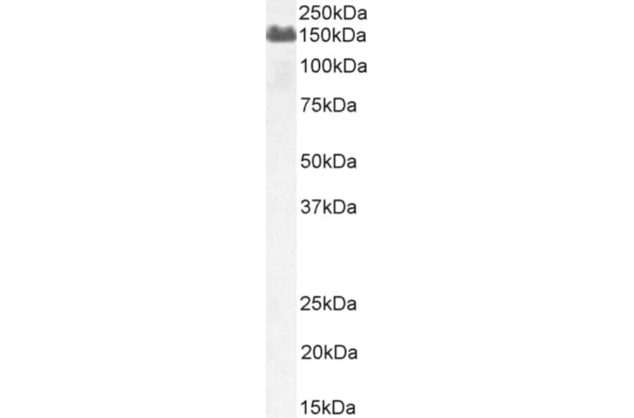 Western Blot - Anti-Factor H Antibody (A82643) - Antibodies.com