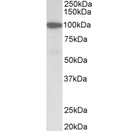 Western Blot - Anti-Gelsolin Antibody (A82644) - Antibodies.com