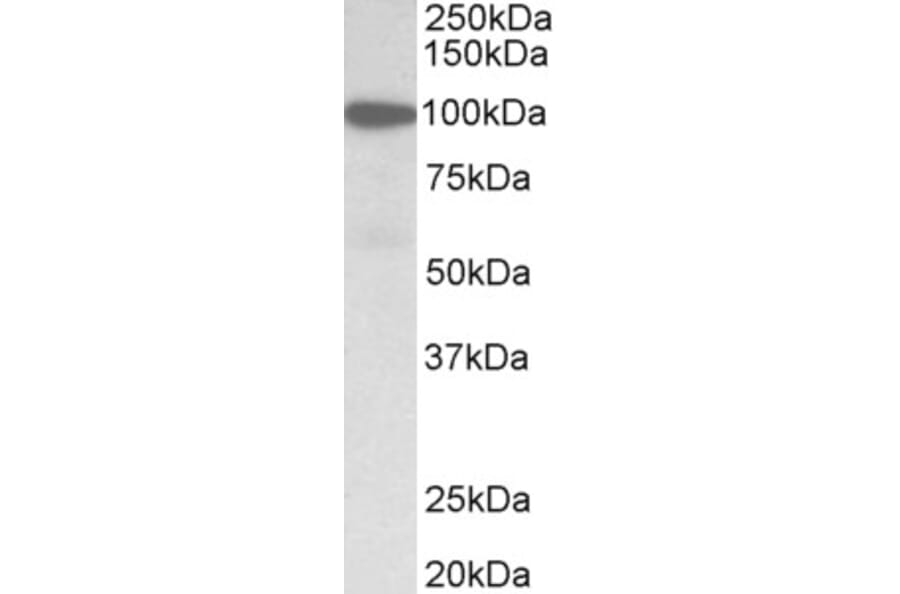 Western Blot - Anti-Gelsolin Antibody (A82644) - Antibodies.com