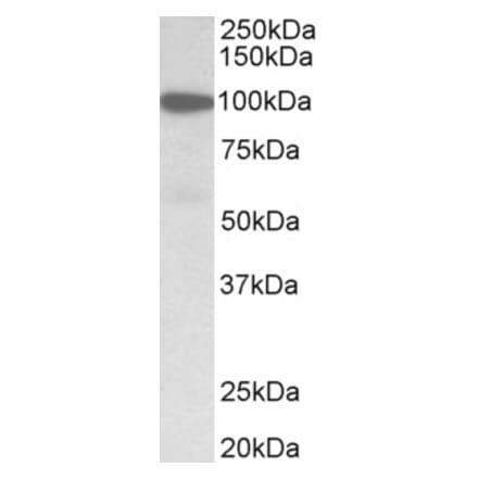 Western Blot - Anti-Gelsolin Antibody (A82644) - Antibodies.com