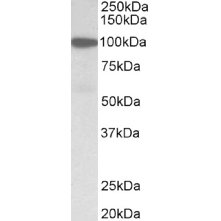 Western Blot - Anti-Gelsolin Antibody (A82644) - Antibodies.com