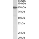 Western Blot - Anti-Gelsolin Antibody (A82644) - Antibodies.com
