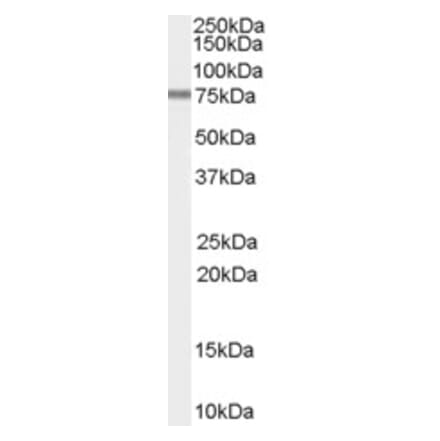 Western Blot - Anti-PDE4D Antibody (A82645) - Antibodies.com