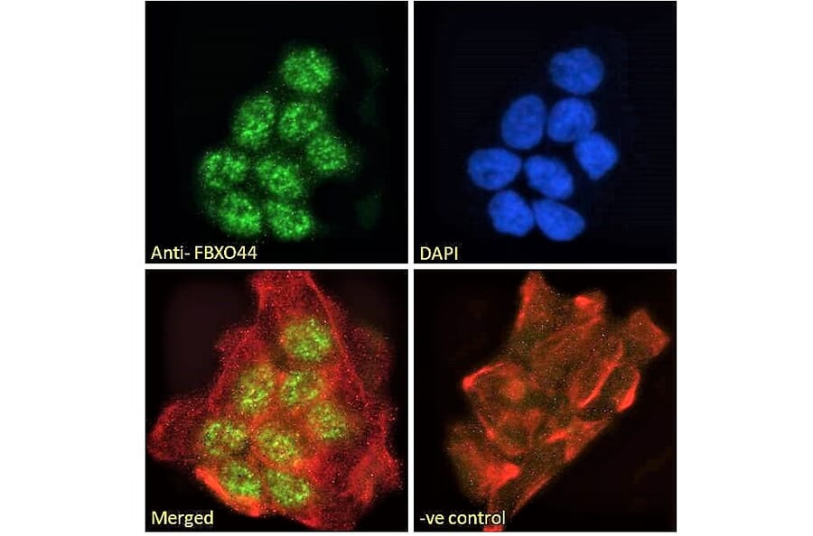 Immunofluorescence - Anti-FBXO44 Antibody (A82647) - Antibodies.com