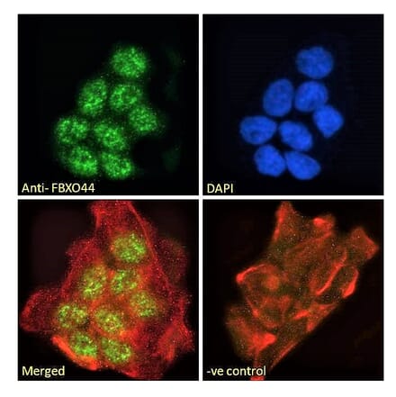 Immunofluorescence - Anti-FBXO44 Antibody (A82647) - Antibodies.com