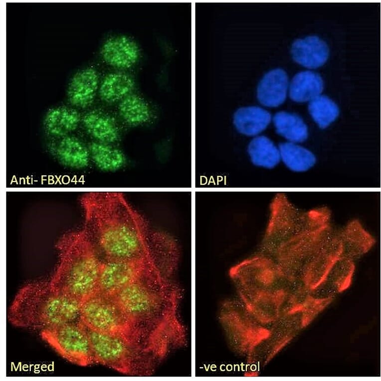 Immunofluorescence - Anti-FBXO44 Antibody (A82647) - Antibodies.com