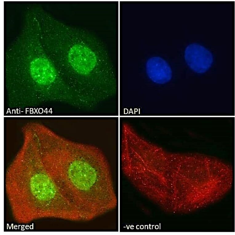 Immunofluorescence - Anti-FBXO44 Antibody (A82647) - Antibodies.com