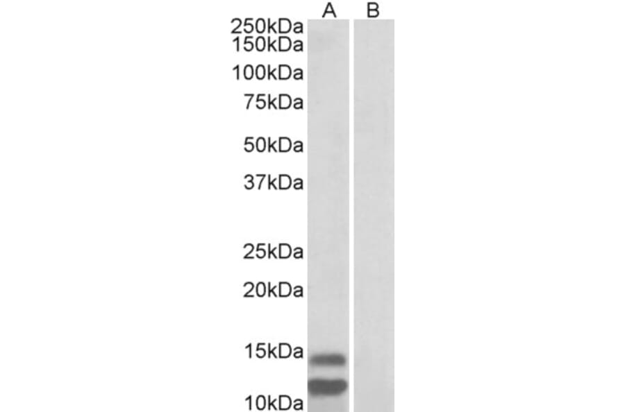 Western Blot - Anti-p15 INK4b Antibody (A82648) - Antibodies.com