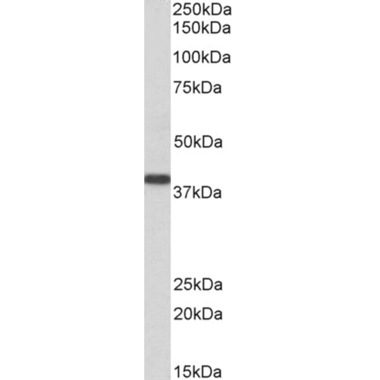 Western Blot - Anti-SET Antibody (A82650) - Antibodies.com