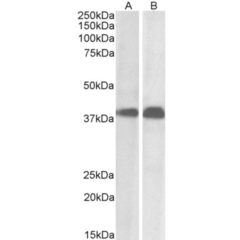 Western Blot - Anti-SET Antibody (A82650) - Antibodies.com