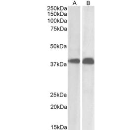 Western Blot - Anti-SET Antibody (A82650) - Antibodies.com