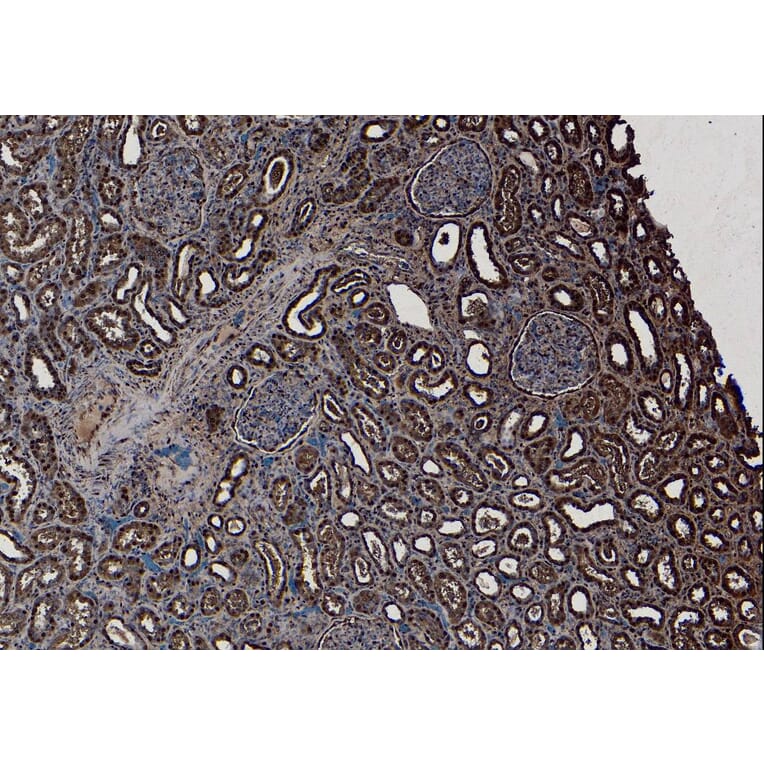 Immunohistochemistry - Anti-SET Antibody (A82650) - Antibodies.com