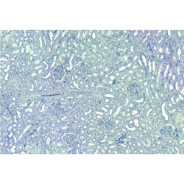 Immunohistochemistry - Anti-SET Antibody (A82650) - Antibodies.com