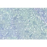 Immunohistochemistry - Anti-SET Antibody (A82650) - Antibodies.com