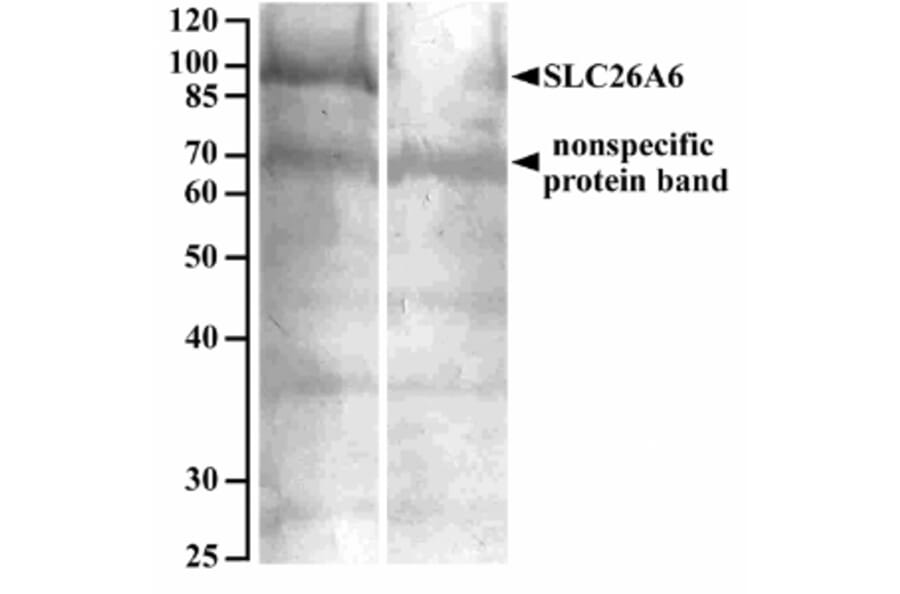 Western Blot - Anti-SLC26A6/Pat1 Antibody (A82652) - Antibodies.com