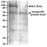 Western Blot - Anti-SLC26A6/Pat1 Antibody (A82652) - Antibodies.com