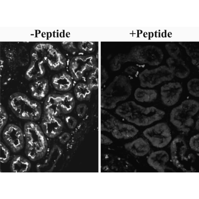 Immunohistochemistry - Anti-SLC26A6/Pat1 Antibody (A82652) - Antibodies.com