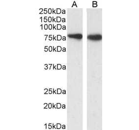 Western Blot - Anti-SLC26A6 Antibody (A82653)