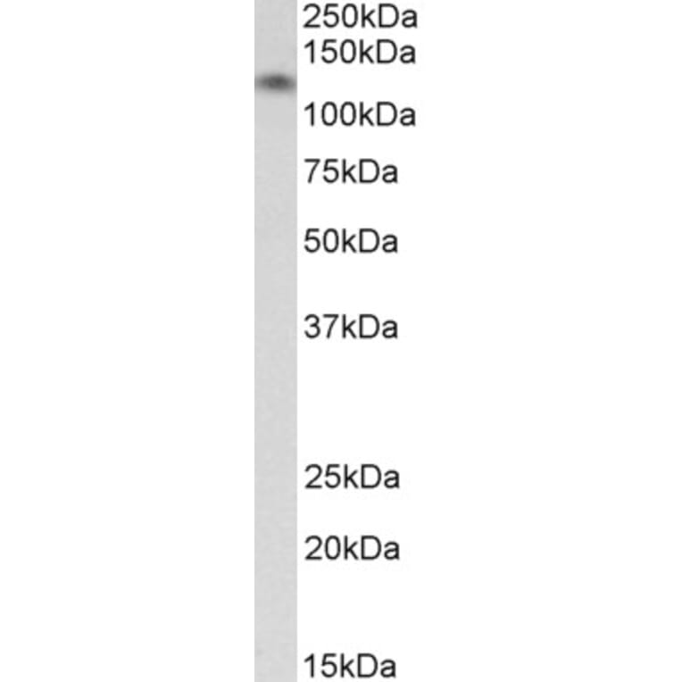 Western Blot - Anti-H Cadherin Antibody (A82654) - Antibodies.com