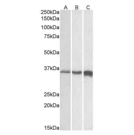 Western Blot - Anti-TNNT3 Antibody (A82655) - Antibodies.com