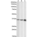 Western Blot - Anti-TNNT3 Antibody (A82655) - Antibodies.com