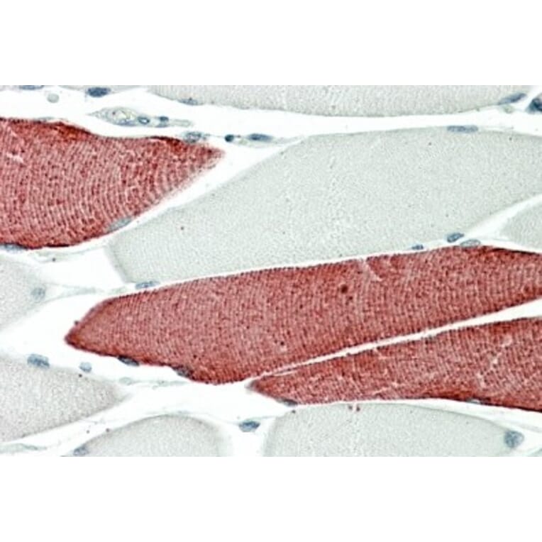 Immunohistochemistry - Anti-TNNT3 Antibody (A82655) - Antibodies.com