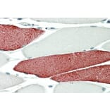 Immunohistochemistry - Anti-TNNT3 Antibody (A82655) - Antibodies.com