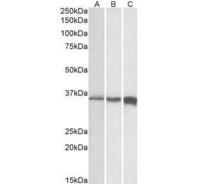 Western Blot - Anti-TNNT3 Antibody (A82655) - Antibodies.com