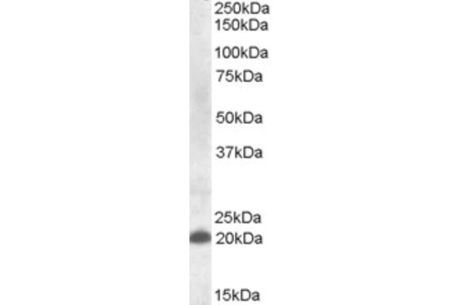 Western Blot - Anti-CLEC4C Antibody (A82658) - Antibodies.com
