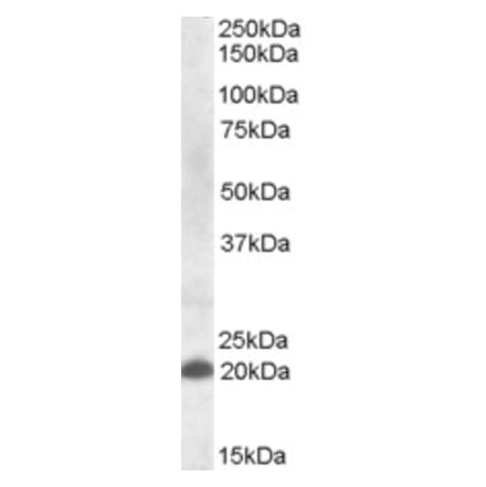 Western Blot - Anti-CLEC4C Antibody (A82658) - Antibodies.com