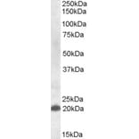 Western Blot - Anti-CLEC4C Antibody (A82658) - Antibodies.com