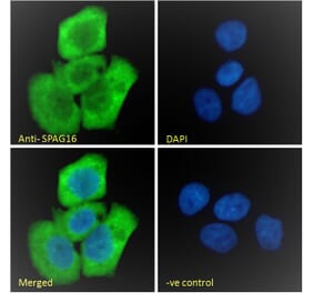 Immunofluorescence - Anti-SPAG16 Antibody (A82659) - Antibodies.com