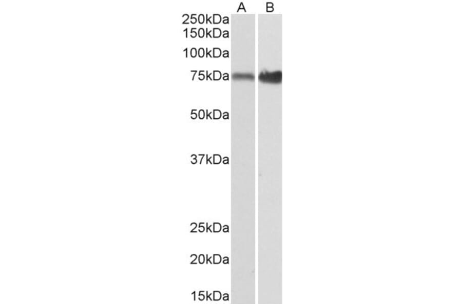 Western Blot - Anti-XPNPEP1 Antibody (A82660) - Antibodies.com