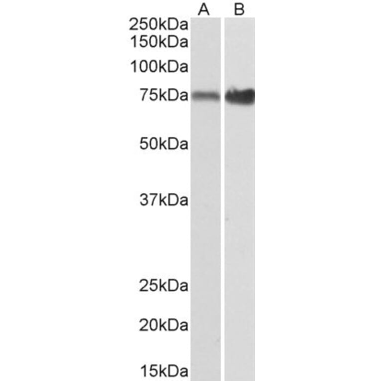 Western Blot - Anti-XPNPEP1 Antibody (A82660) - Antibodies.com