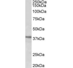 Western Blot - Anti-C12orf29 Antibody (A82663) - Antibodies.com