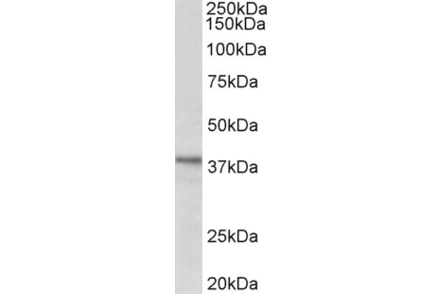 Western Blot - Anti-C12orf29 Antibody (A82663) - Antibodies.com