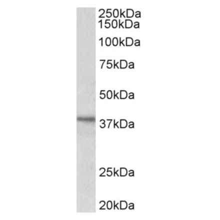 Western Blot - Anti-C12orf29 Antibody (A82663) - Antibodies.com