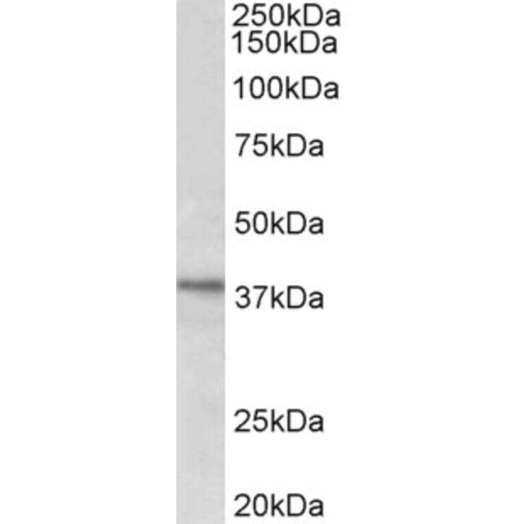 Western Blot - Anti-C12orf29 Antibody (A82663) - Antibodies.com