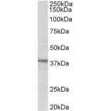 Western Blot - Anti-C12orf29 Antibody (A82663) - Antibodies.com