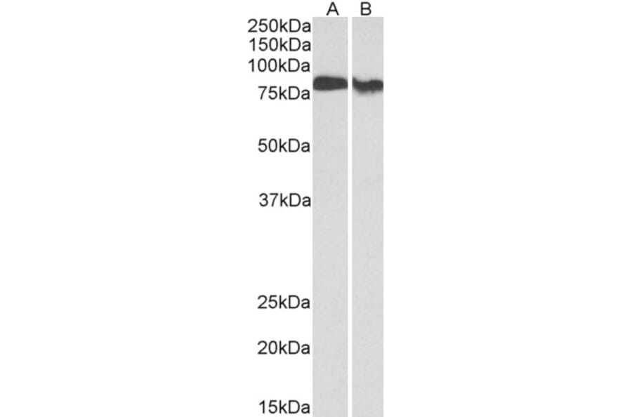 Western Blot - Anti-PKC beta Antibody (A82664) - Antibodies.com