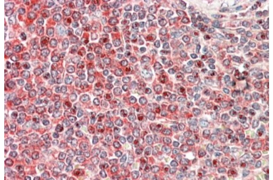 Immunohistochemistry - Anti-PKC beta Antibody (A82664) - Antibodies.com