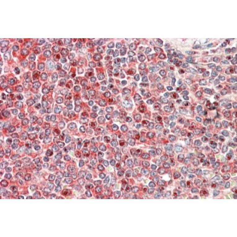 Immunohistochemistry - Anti-PKC beta Antibody (A82664) - Antibodies.com