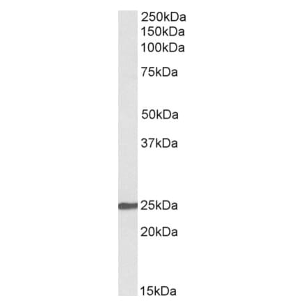 Western Blot - Anti-NBL1 Antibody (A82666) - Antibodies.com