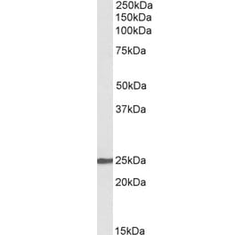 Western Blot - Anti-NBL1 Antibody (A82666) - Antibodies.com