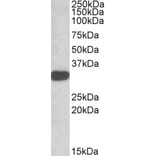 Western Blot - Anti-TIPRL Antibody (A82667) - Antibodies.com