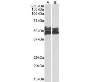 Western Blot - Anti-FCRL1 Antibody (A82669) - Antibodies.com