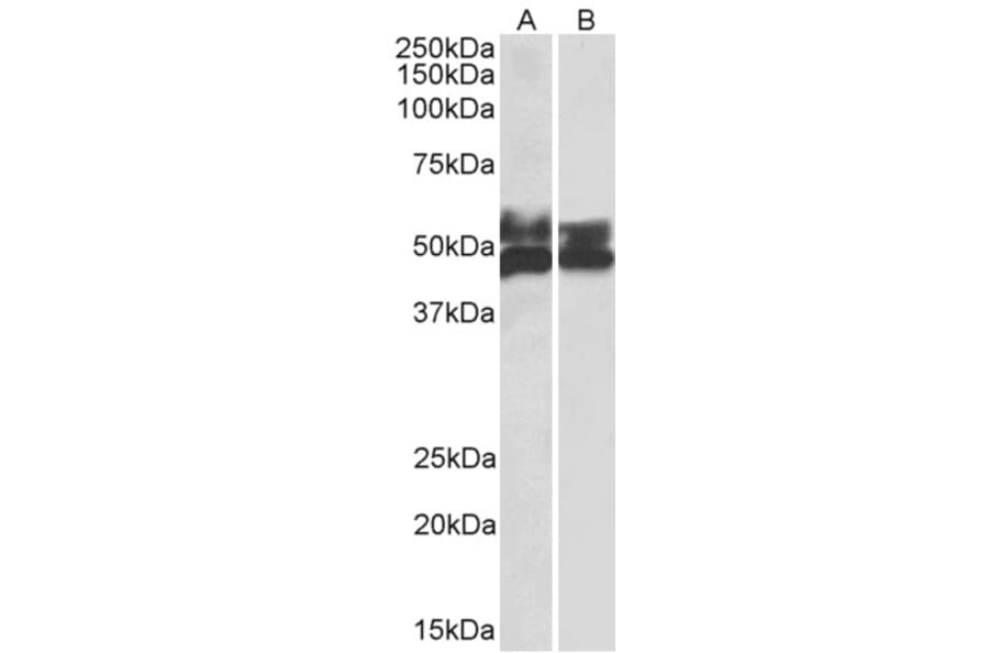 Western Blot - Anti-FCRL1 Antibody (A82669) - Antibodies.com