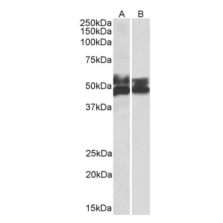 Western Blot - Anti-FCRL1 Antibody (A82669) - Antibodies.com