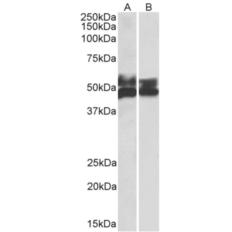 Western Blot - Anti-FCRL1 Antibody (A82669) - Antibodies.com